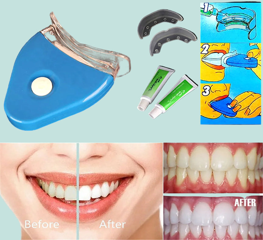 LED Zahnaufhellungs-Set mit Whitening Gel – Für ein sichtbar strahlenderes Lächeln